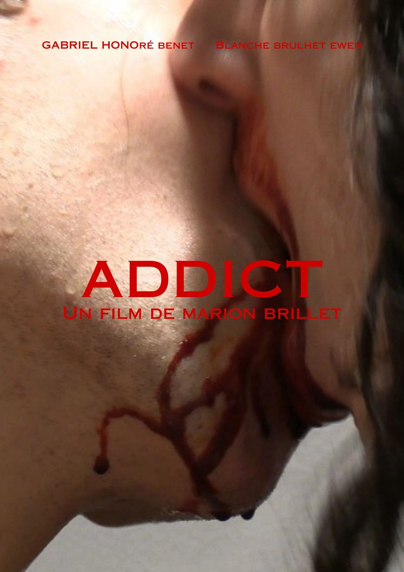 ADDICT