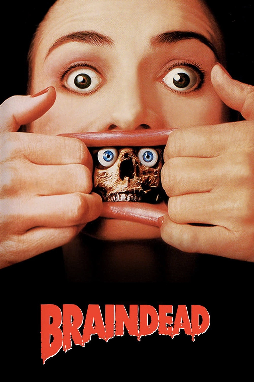 Braindead