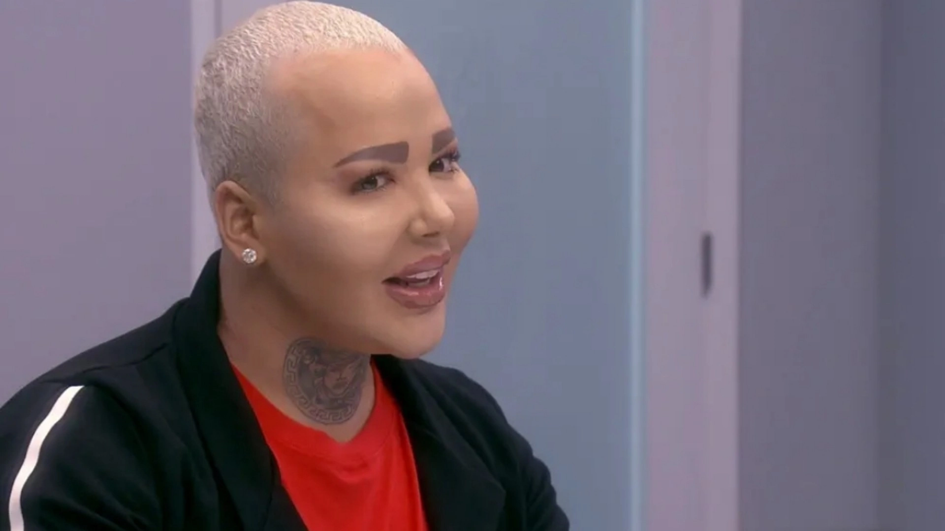Botched