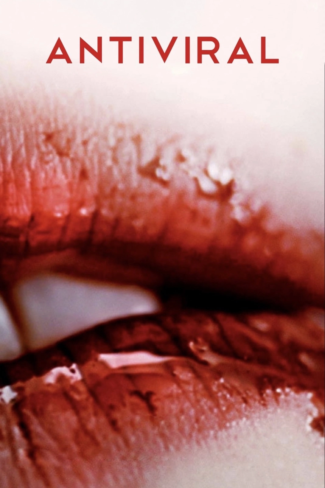 Antiviral