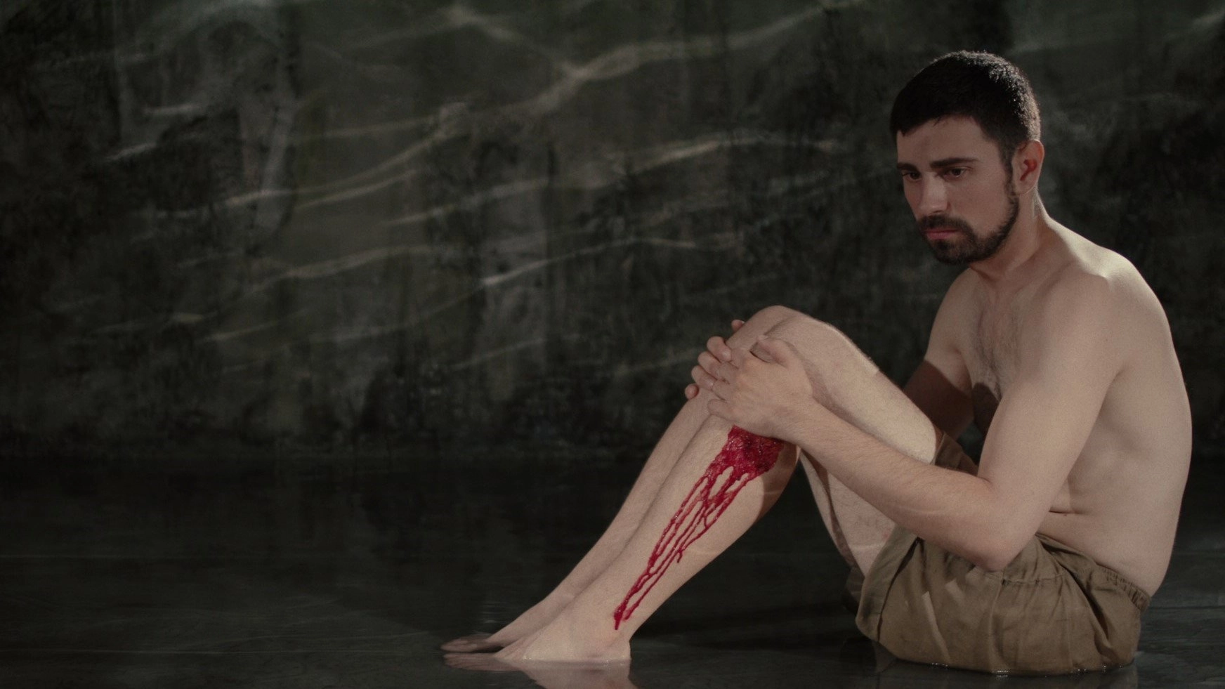 Wound
