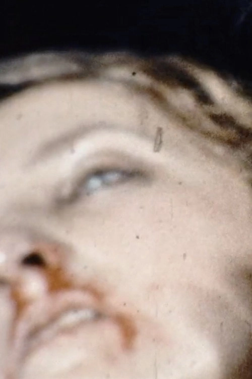 Eyelashes