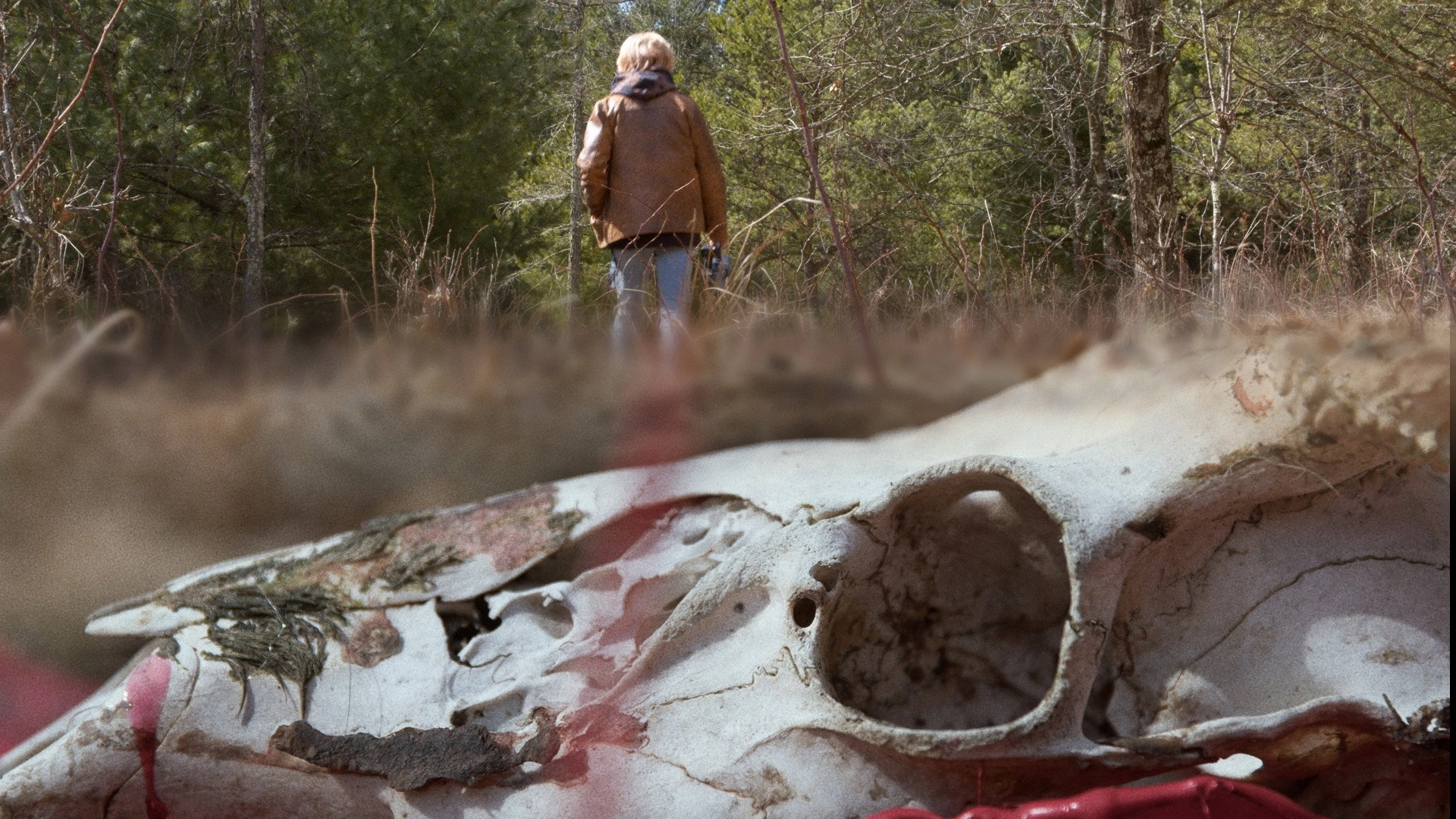 Chronic Wasting