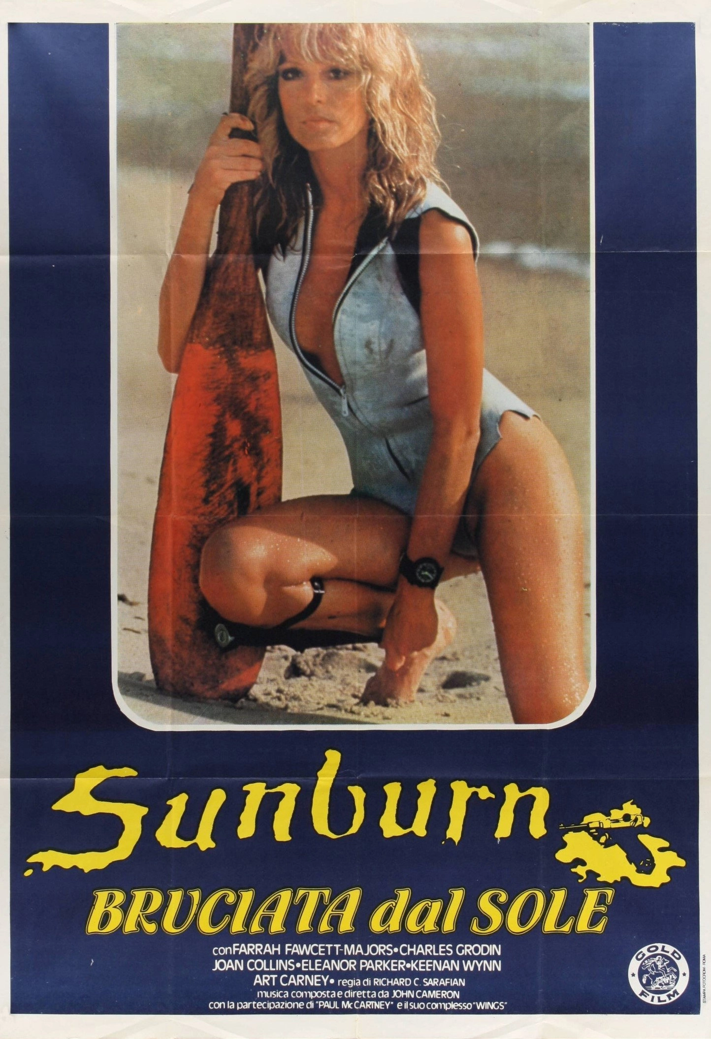 Sunburn