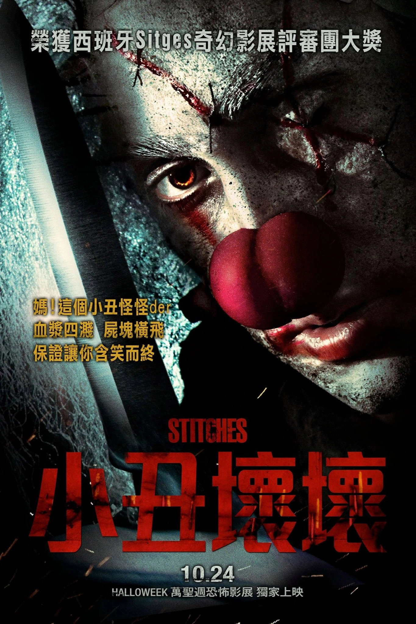 Stitches