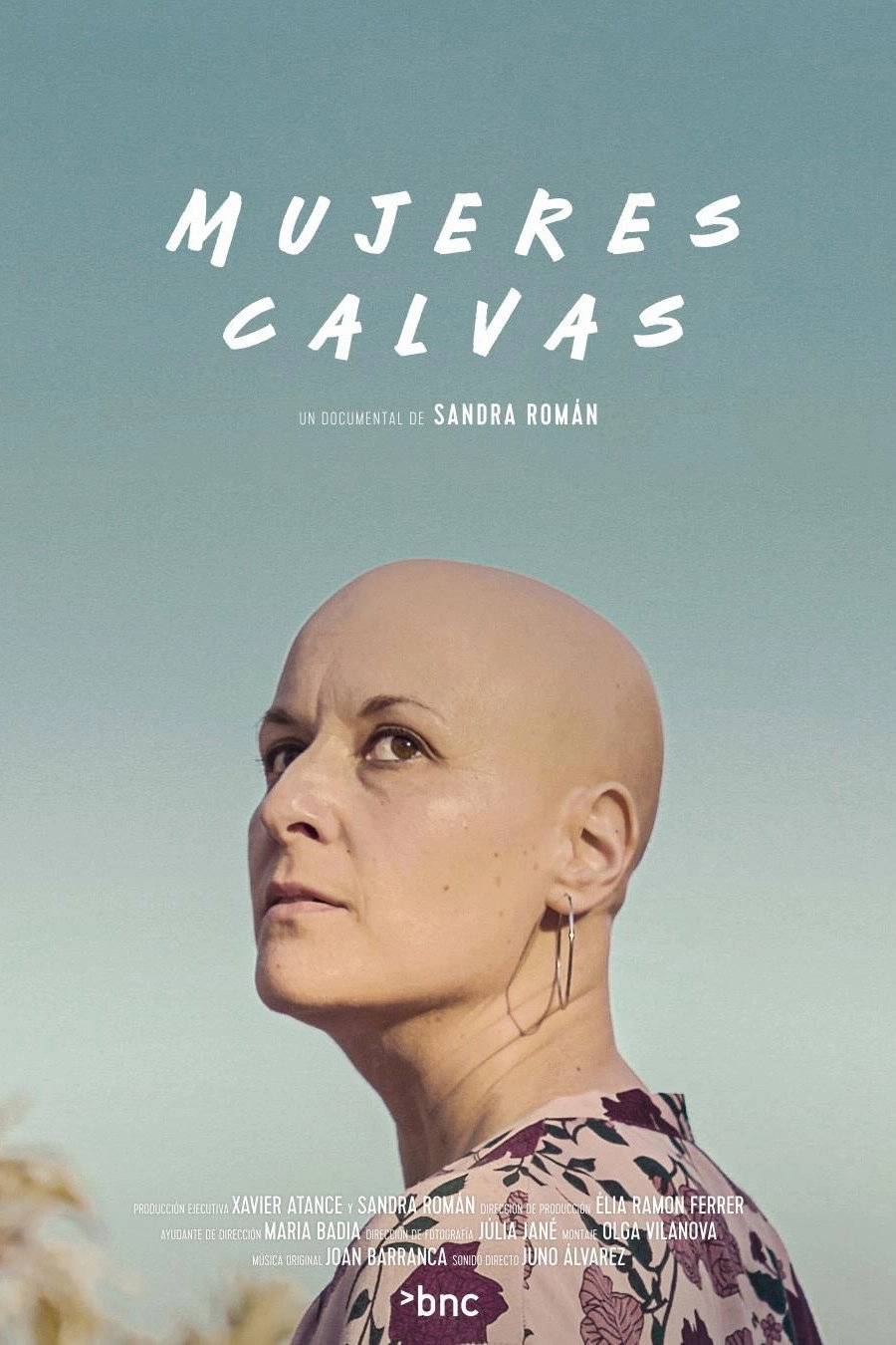 Bald Women