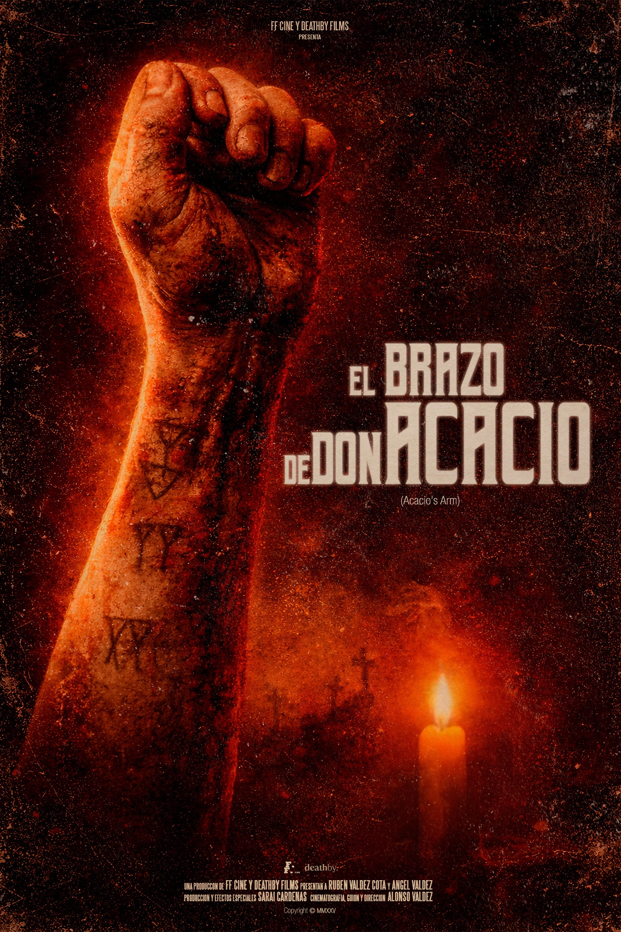Acacio's Arm