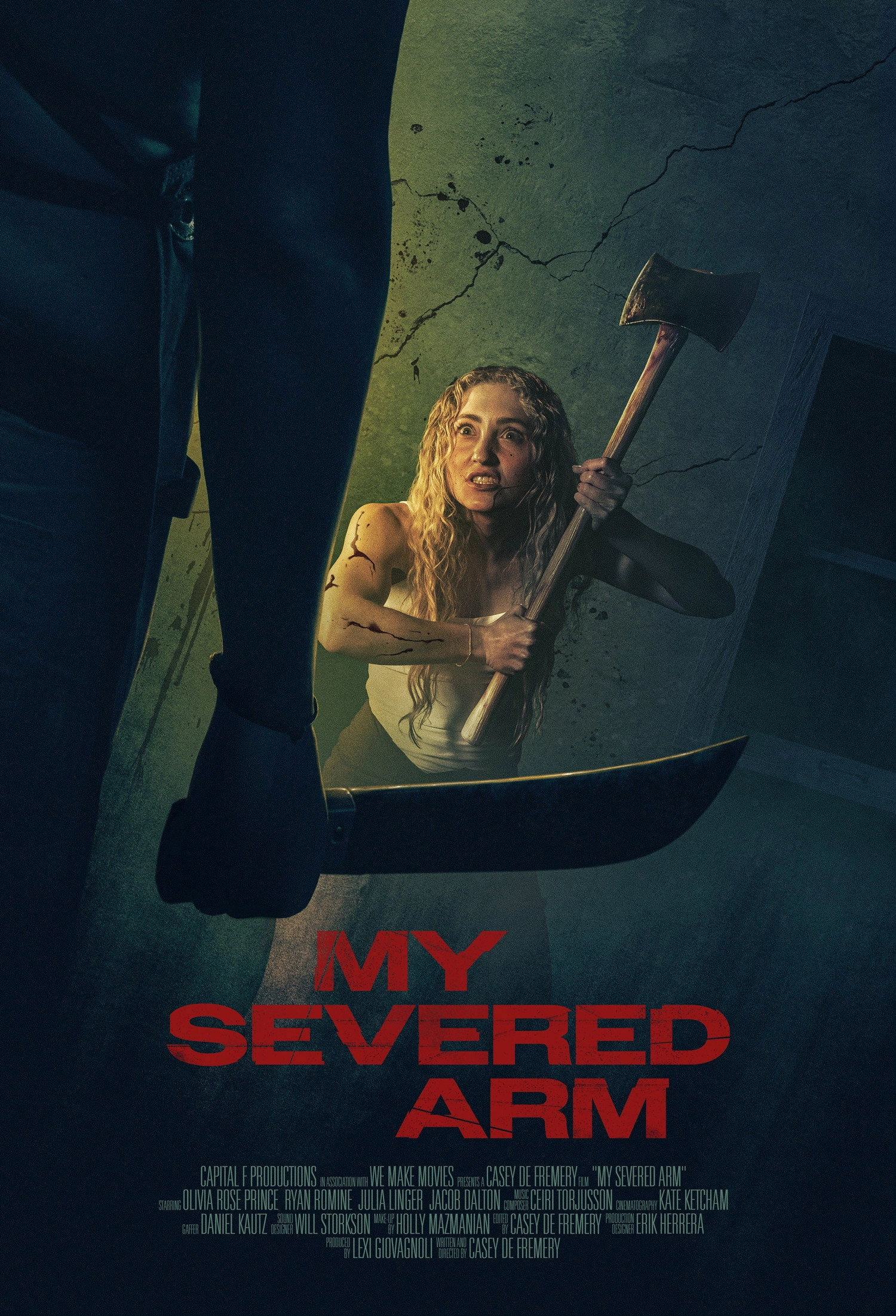 My Severed Arm