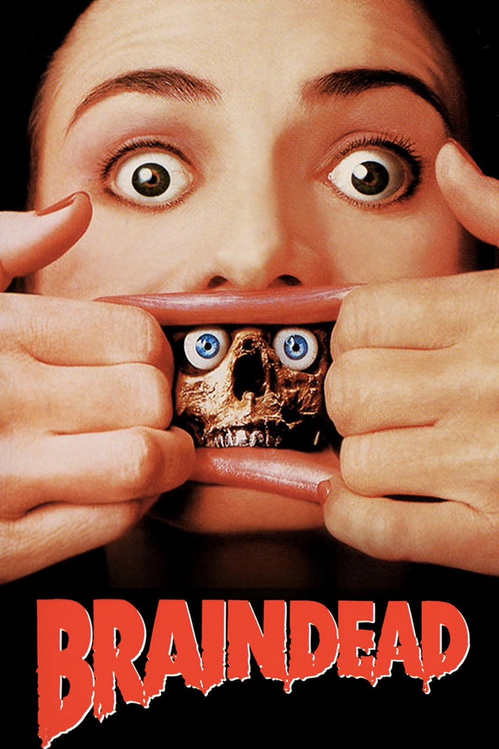 Braindead
