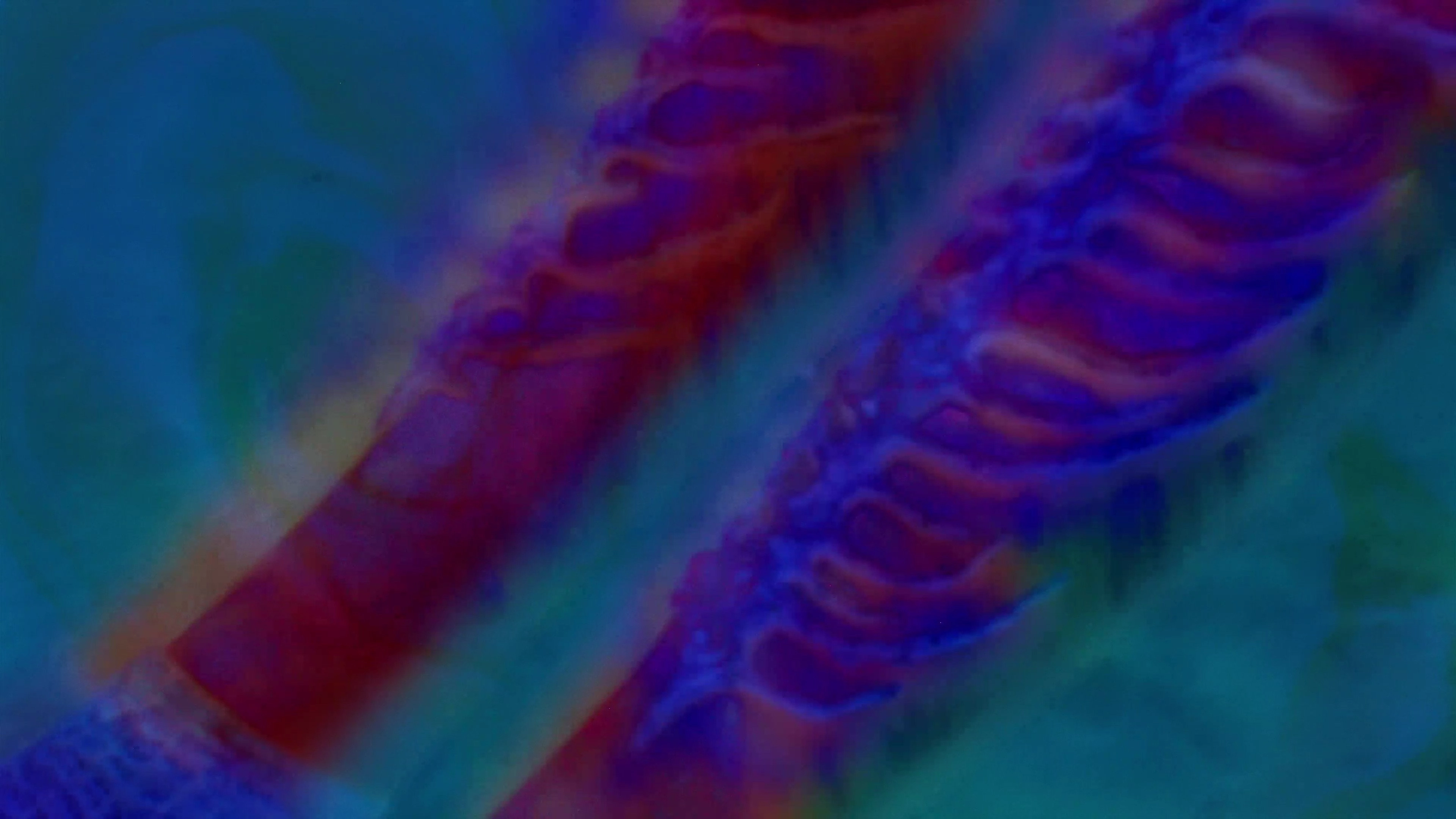 Resonga la Marea