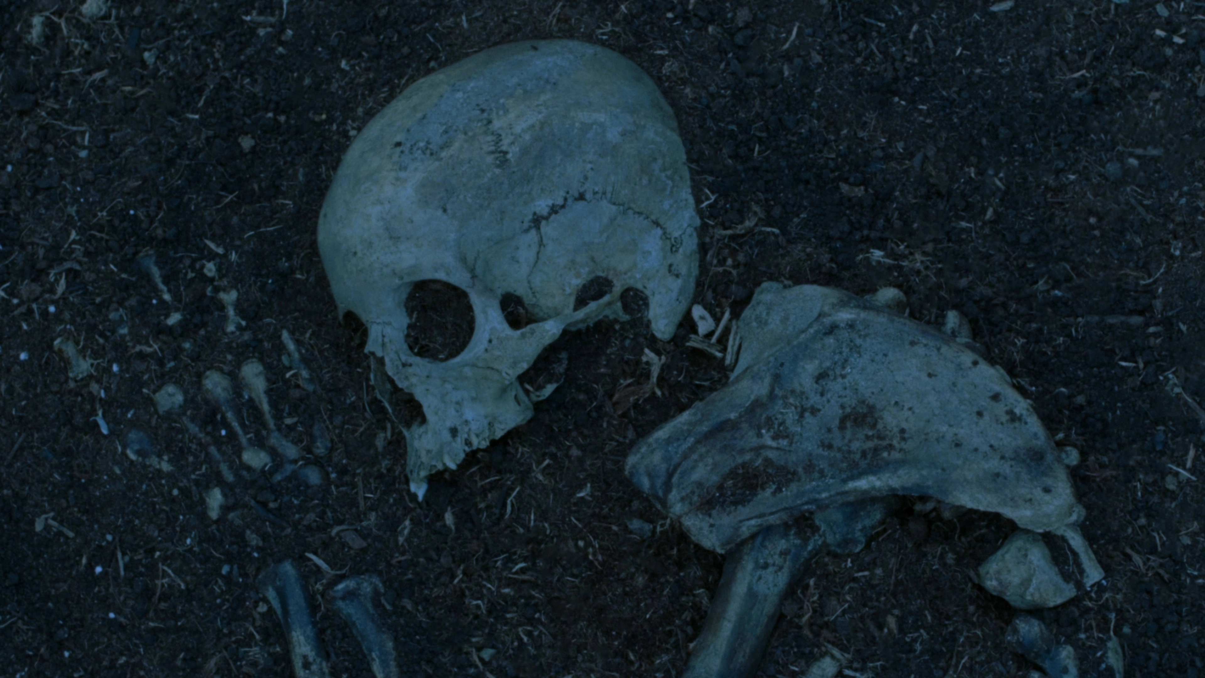 Bones