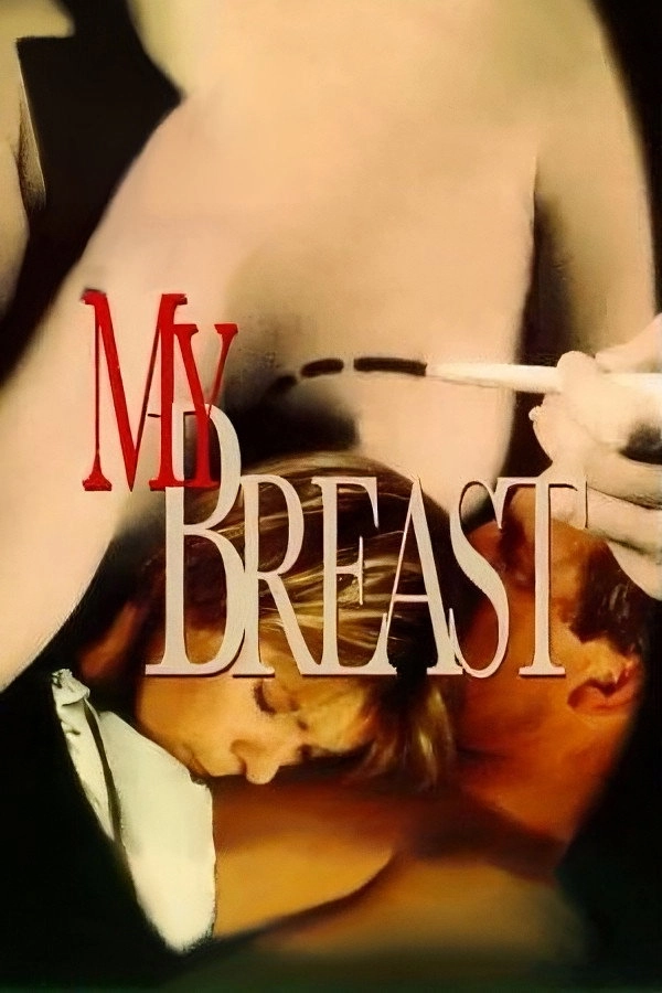 My Breast