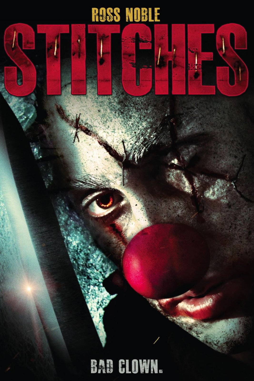 Stitches