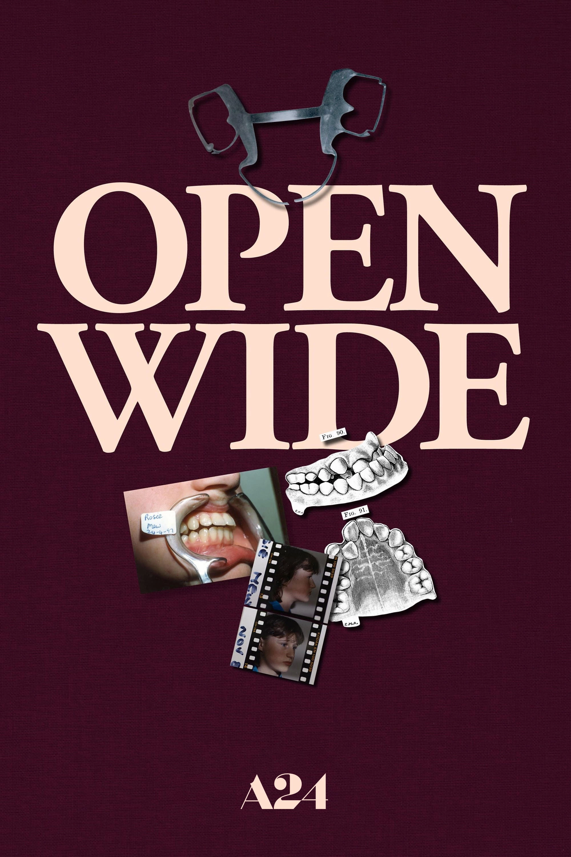 Open Wide