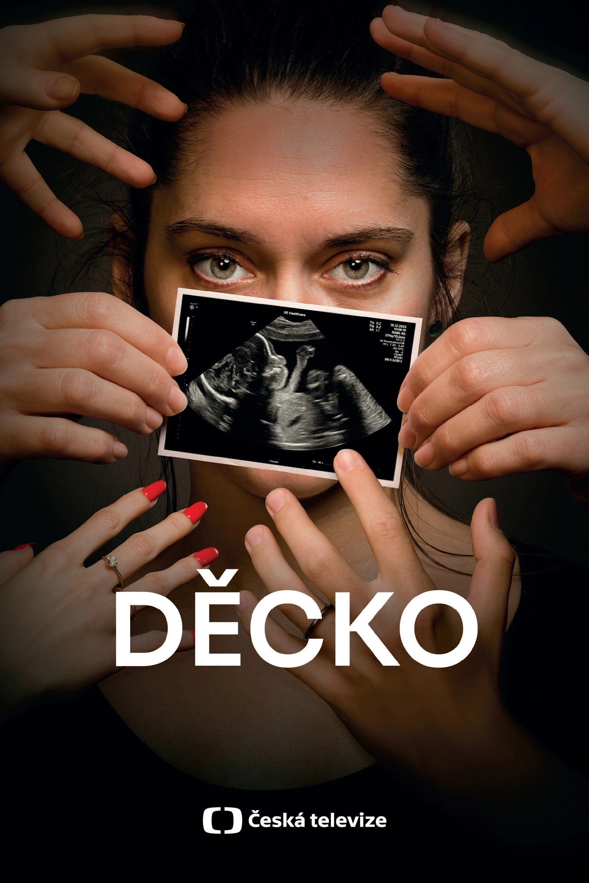Děcko