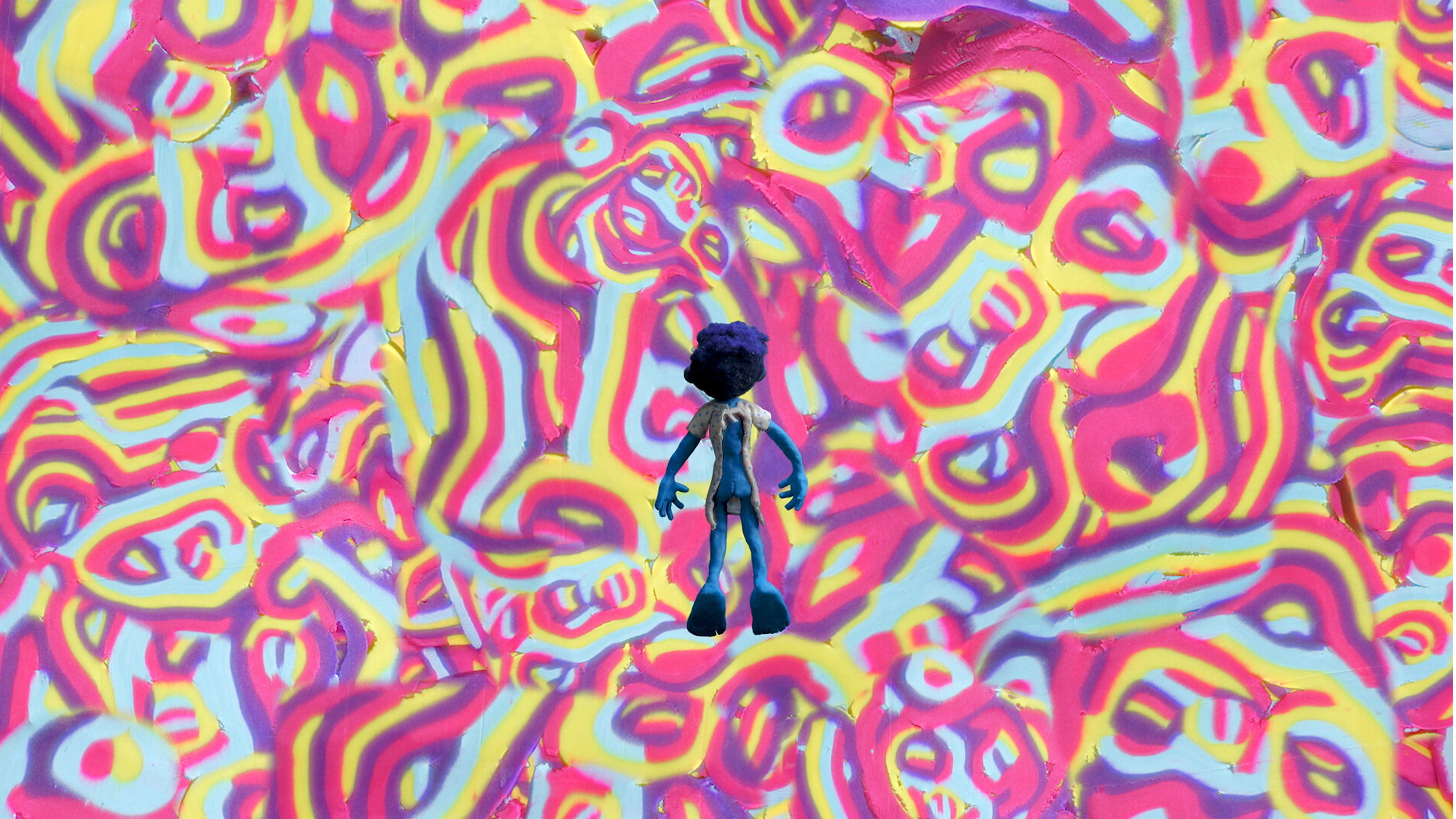 MRI