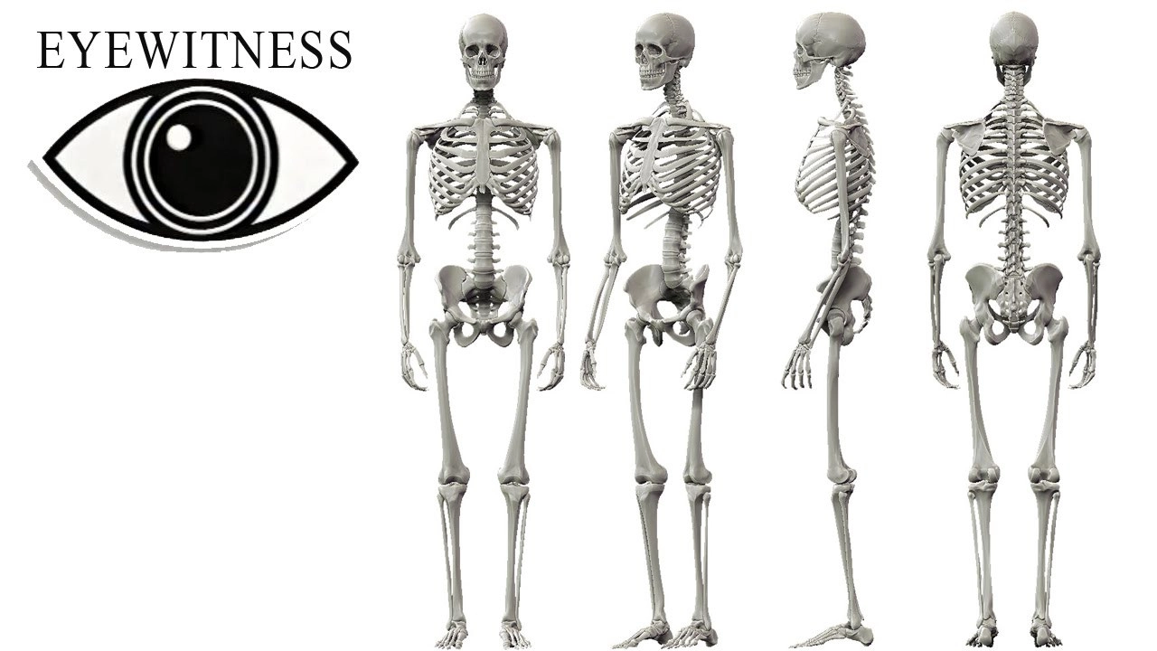 Eyewitness
