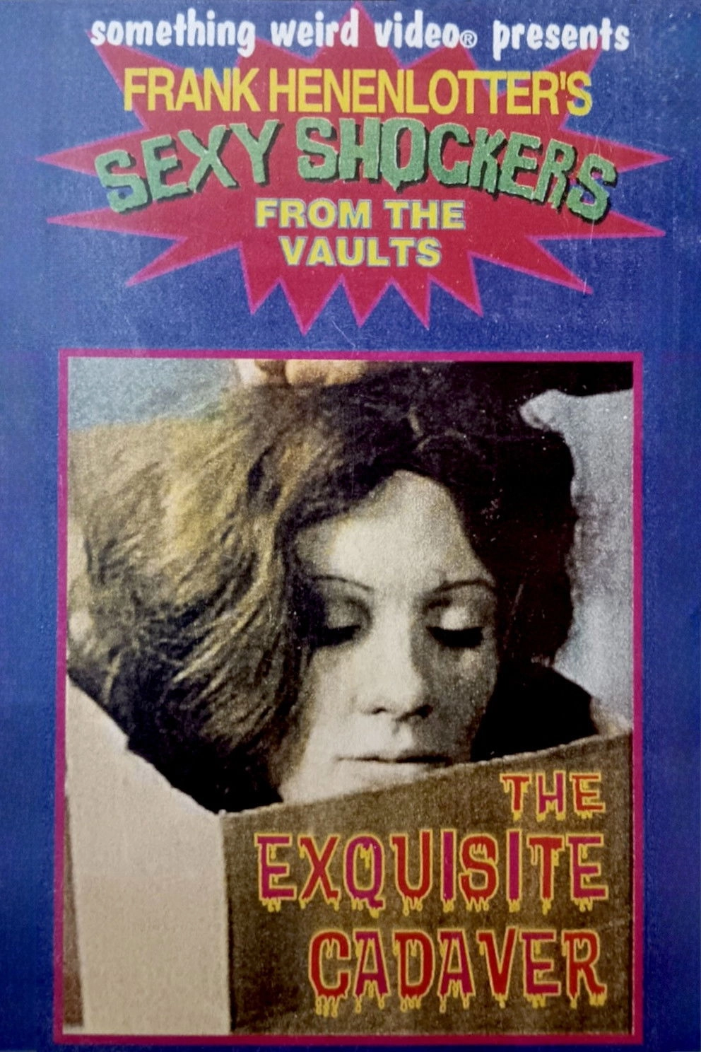 The Exquisite Cadaver