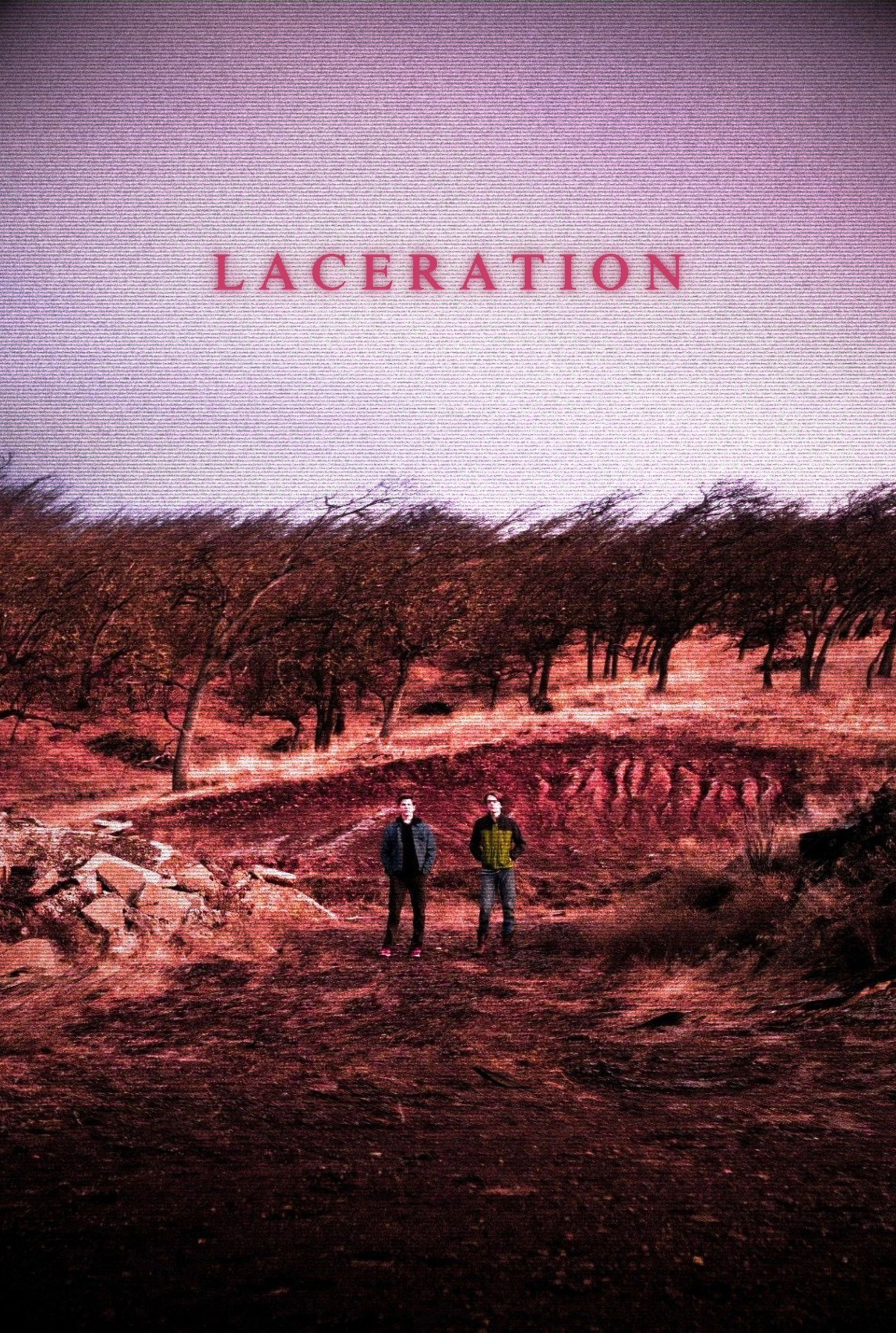 Laceration
