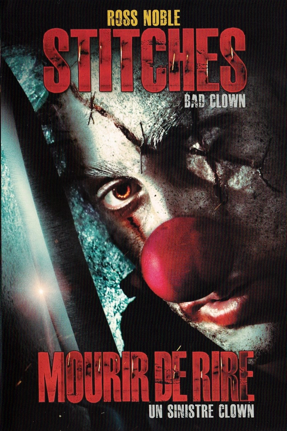 Stitches