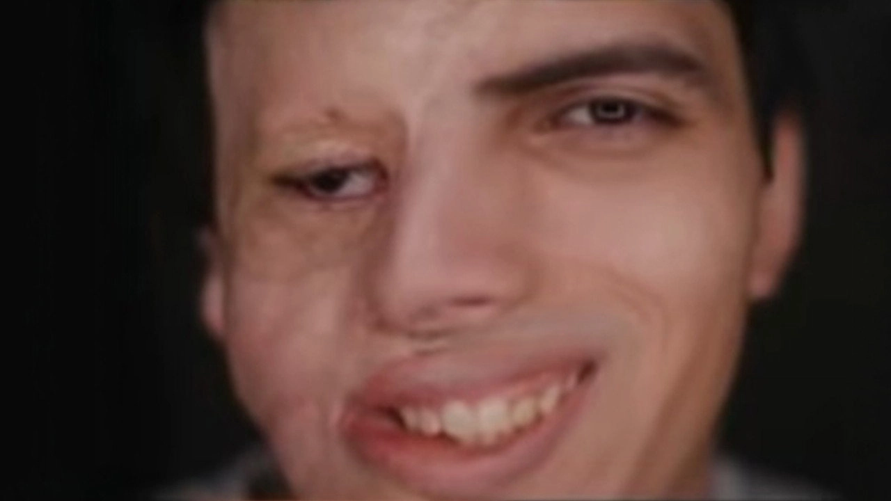 About Face