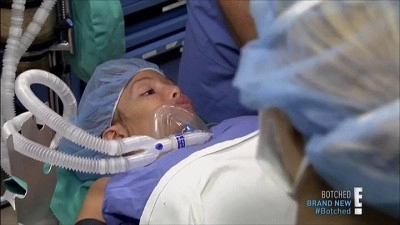 Botched