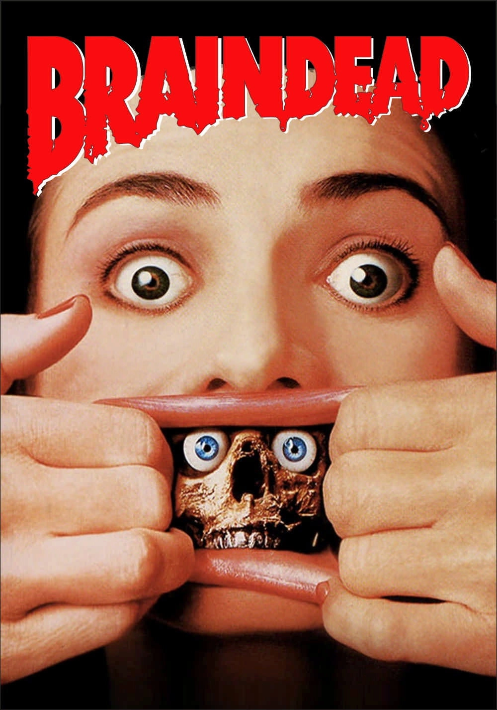 Braindead