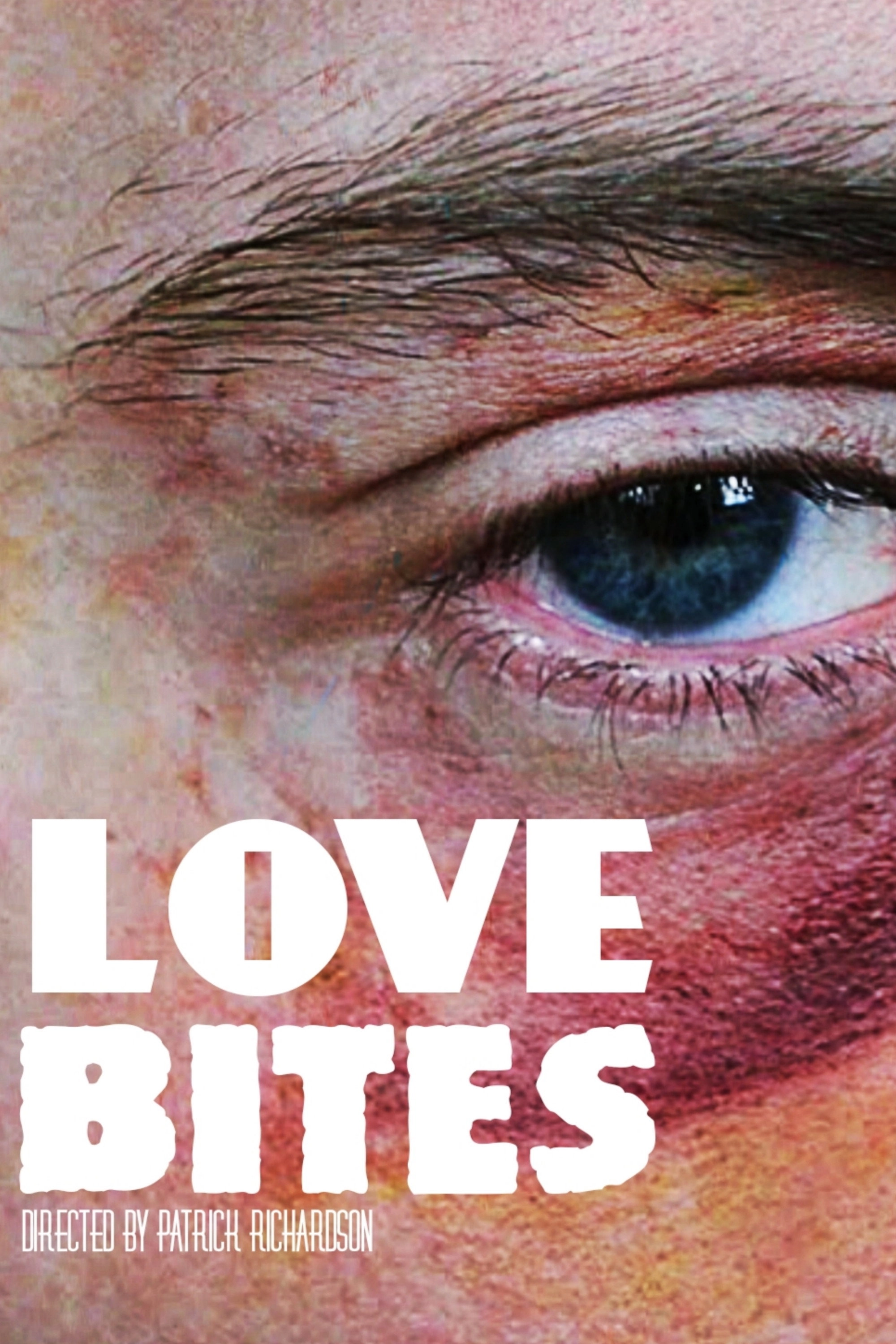 Love Bites