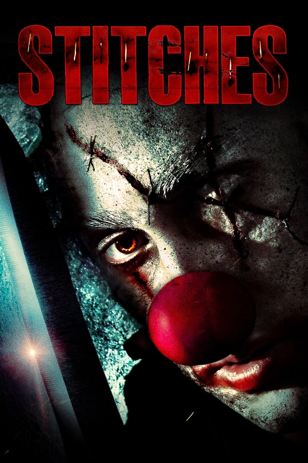Stitches