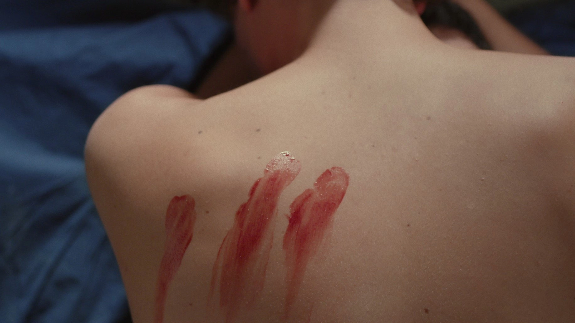 Wound