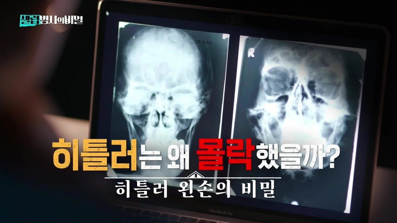 Medical Mysteries of Celebrities